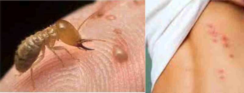 bị mối cắn có sao không